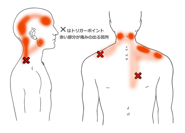 付け根 首 こり の 首がミシミシなる…肩こりの予防・解消に首の1分ストレッチ！ [肩こり]